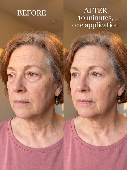 Viperaderm Instant Lift Formula