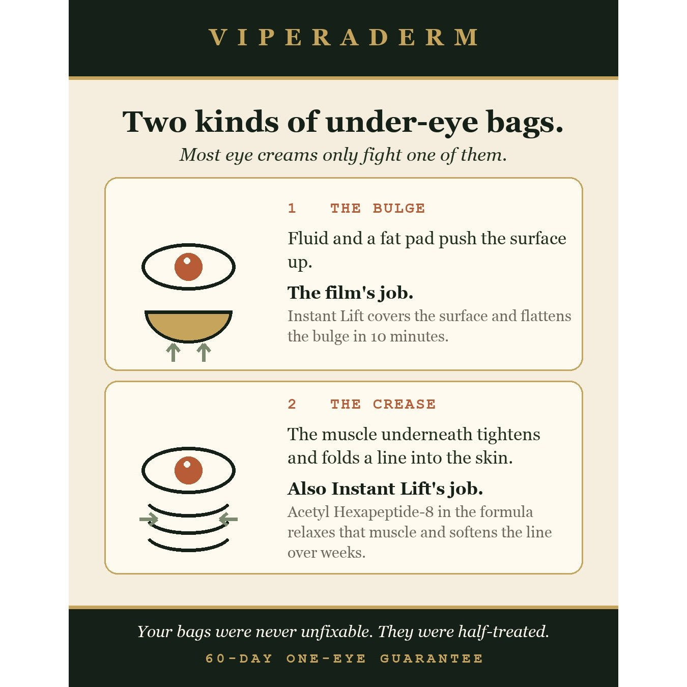 Two kinds of under-eye bags: the bulge and the crease