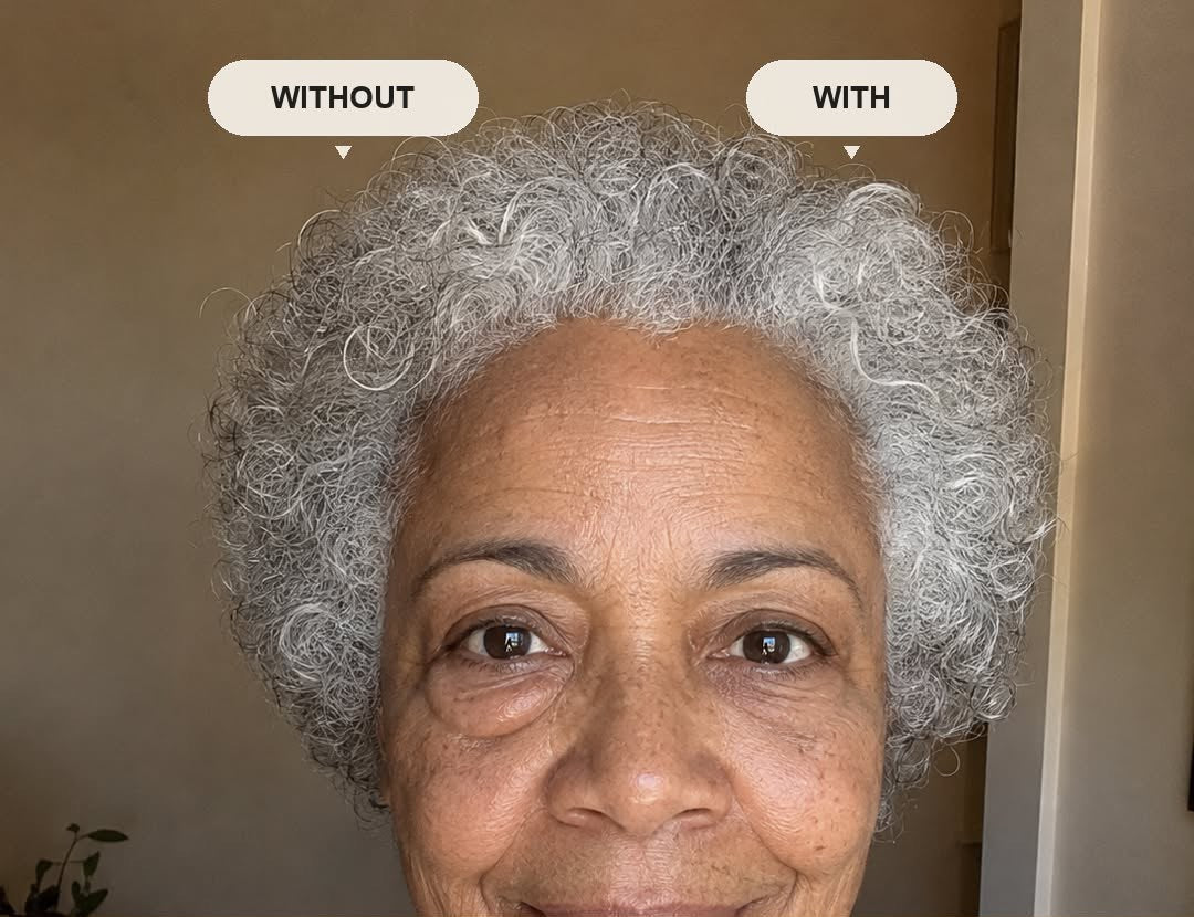One eye with Instant Lift, one eye without